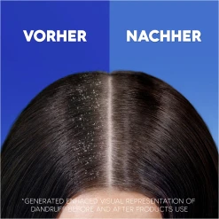 Head & Shoulders Haarshampoo Anti-Schuppen Citrus Fresh 13 Head & Shoulders Haarshampoo Anti-Schuppen Citrus Fresh -Mandarina Duck Fragrances-Shop MAM 10411338 SHOP IMAGE 1.4