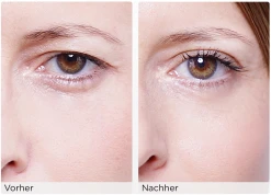 WONDERSTRIPES Augenlid-Liftingstripes Gr. M -Mandarina Duck Fragrances-Shop MAM 3810469 SHOP IMAGE 1.4