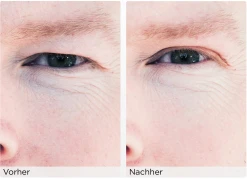 WONDERSTRIPES Augenlid-Liftingstripes Gr. M -Mandarina Duck Fragrances-Shop MAM 3810471 SHOP IMAGE 1.4